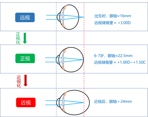眼球2.png